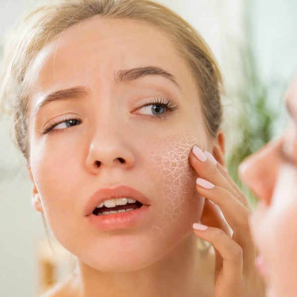 ¿Cómo combatir la sequedad del rostro?