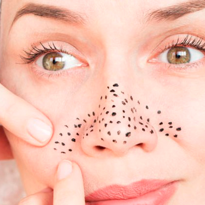 Aprende a extraer los puntos negros