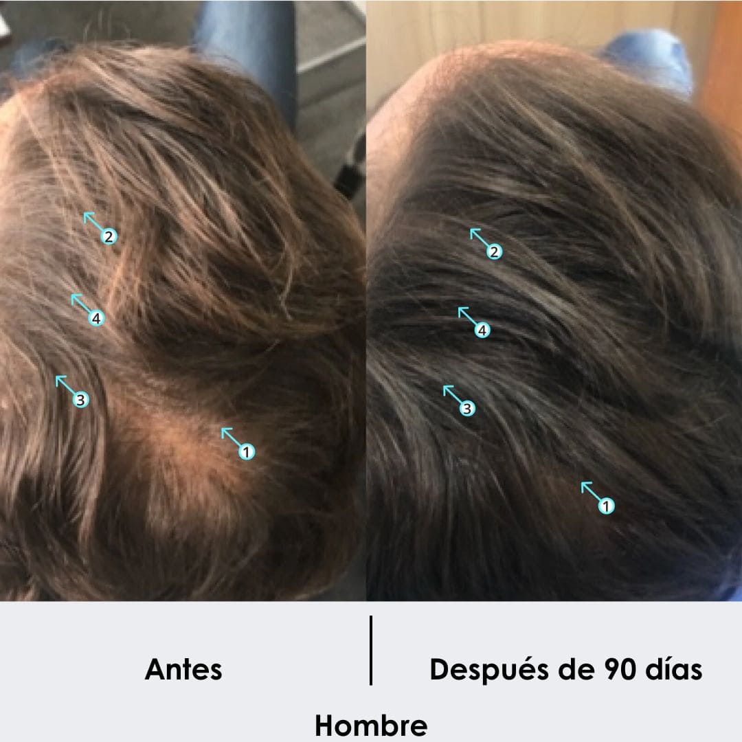 Tratamiento Anticaida + Crecimiento de Cabello Shampoo 250 ML