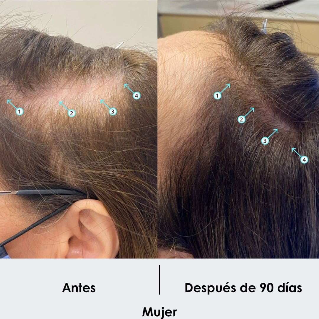 Tratamiento Anticaida + Crecimiento de Cabello Shampoo 250 ML