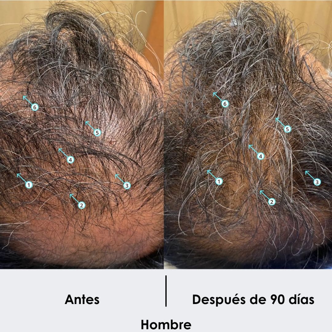 Tratamiento Anticaida + Crecimiento de Cabello Shampoo 250 ML